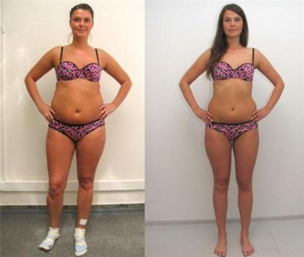 Фото до и после безуглеводной диеты