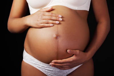 Что означает тёмная полоска на животе при беременности? Когда и почему она появляется?