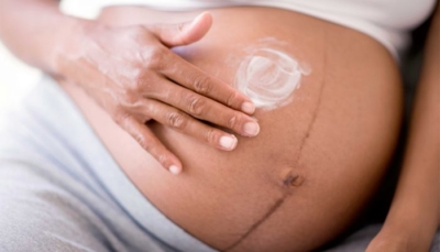 Что означает тёмная полоска на животе при беременности? Когда и почему она появляется?