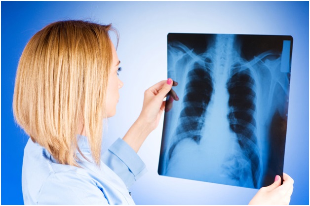 Чем опасен туберкулез для больного и окружающих?