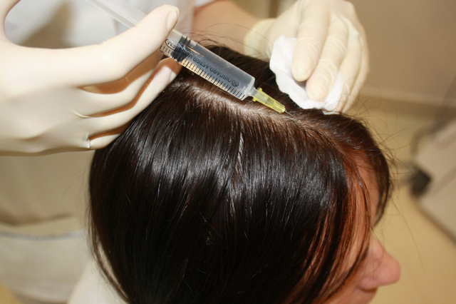 проведение процедуры биоревитализации волос